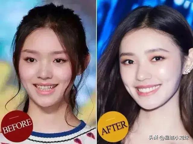 蔡徐坤前东家晒整形费用，整容花了70多万，做头发花了80多万