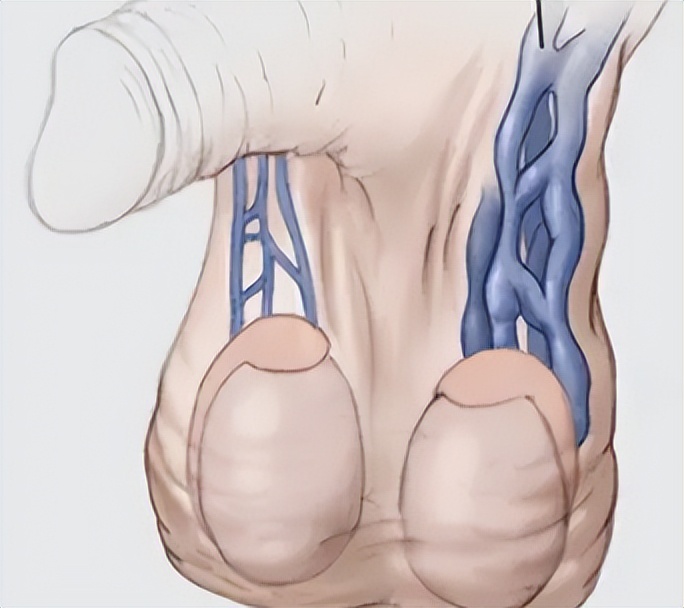 在夜里睾丸潮湿是啥病,最近一段时间睾丸附近总是很潮湿