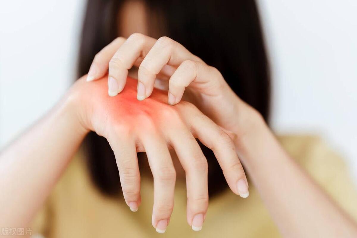 每次我与丈夫深入交流后，都浑身瘙痒难耐，居然对这种东西过敏