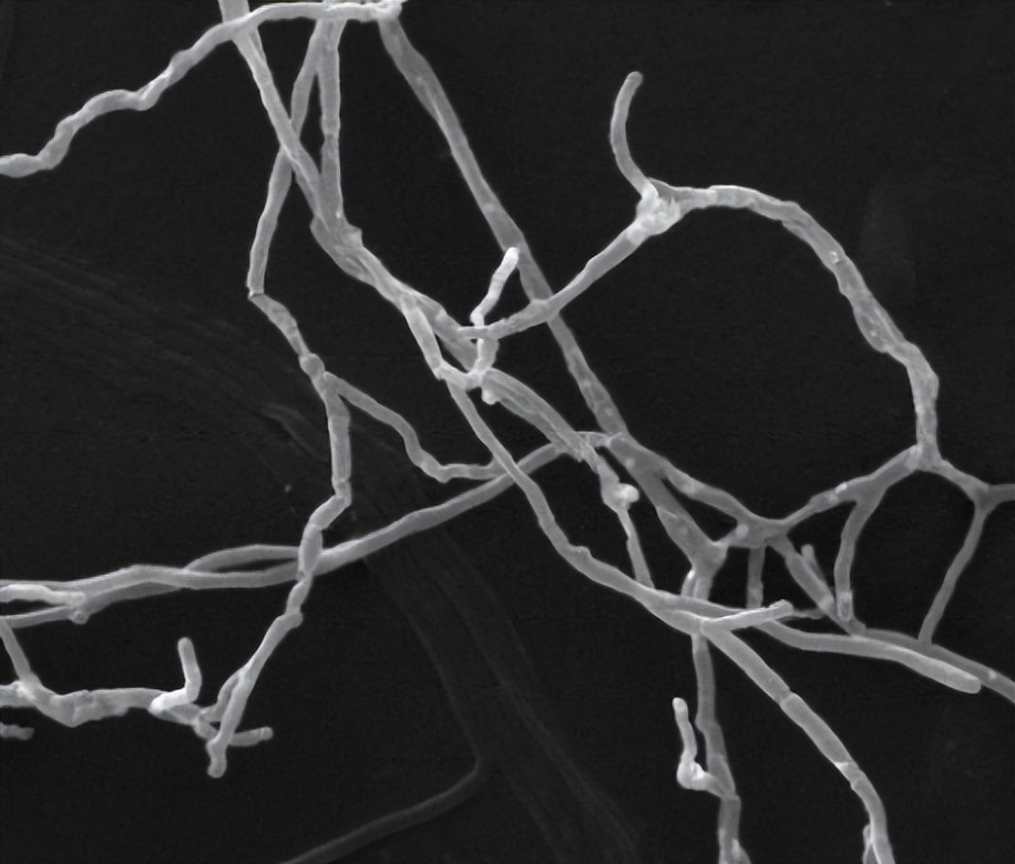 放线菌菌剂的作用包括哪些,放线菌代谢产物的作用