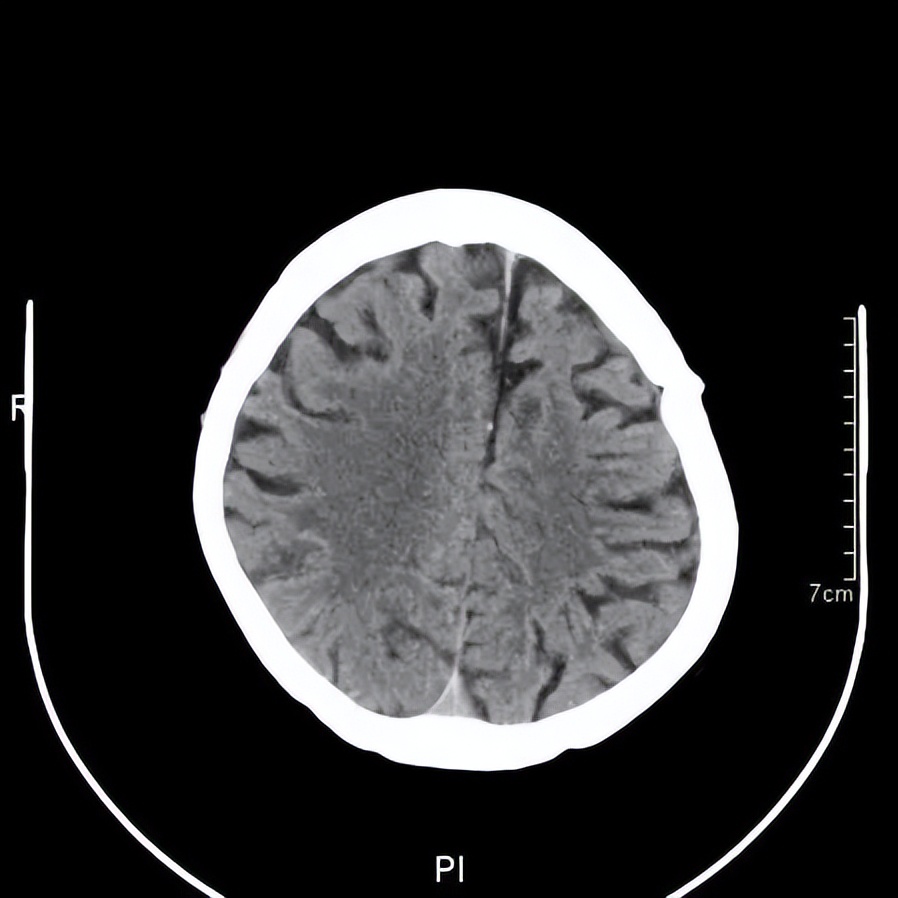 记忆门诊深圳,记忆门诊诊疗流程
