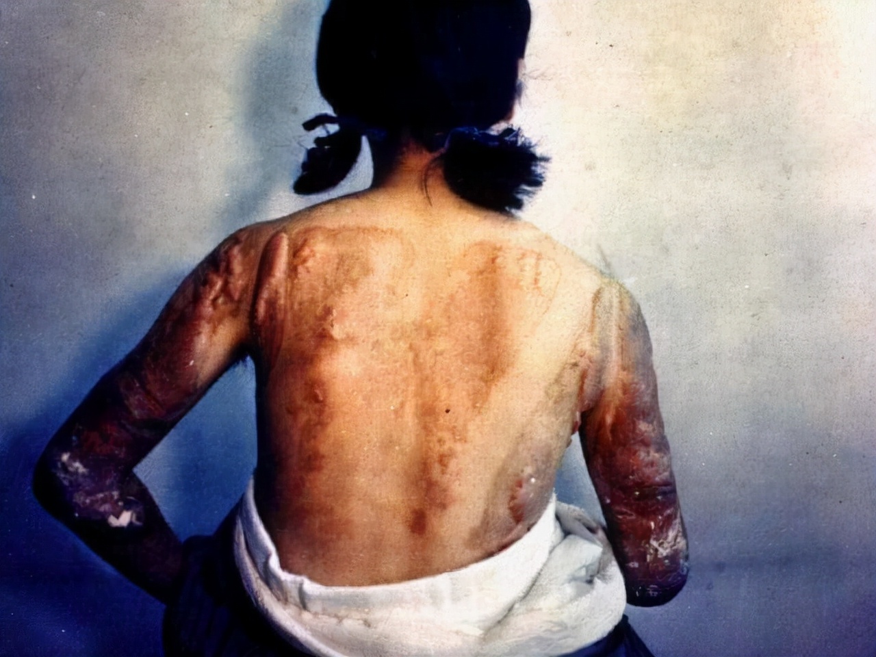 核辐射过的日本广岛怎么样了,广岛核爆辐射存在了多久