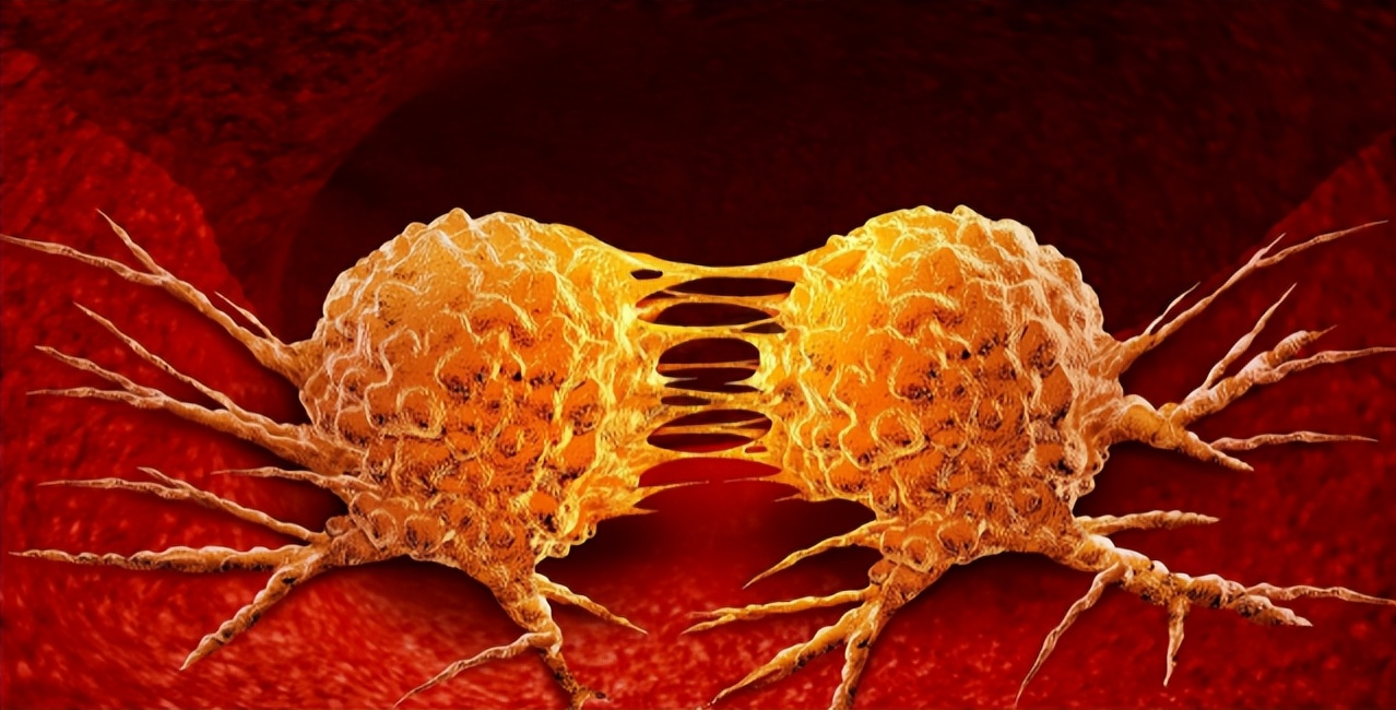 2种水果是癌症克星,癌症最怕的一种蔬菜每天吃一个