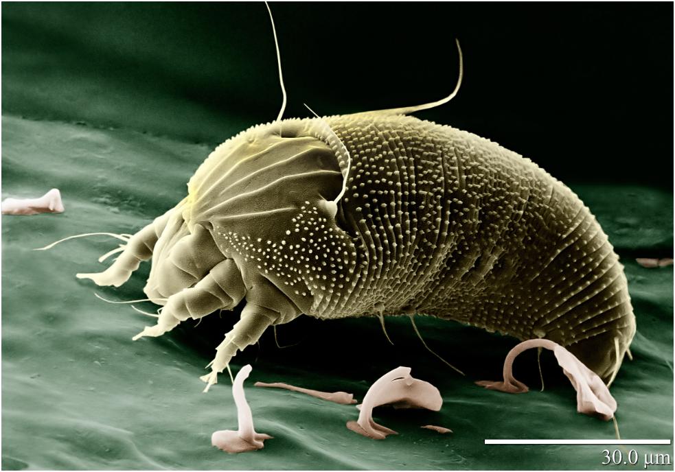 耳朵特别痒又掏不出耳屎怎么办,耳朵里痒一掏就流水是什么原因