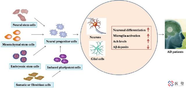 日本干细胞治疗哪些疾病,日本干细胞技术治疗疾病
