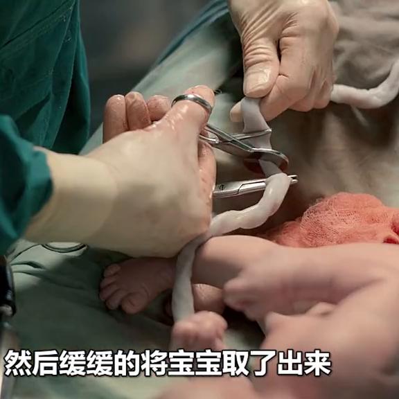 治愈电影解说侏儒症,一部关于侏儒症的电影