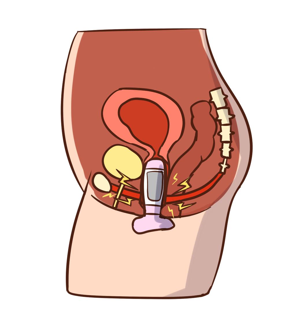 啪啪时女生阴道发出“噗噗”的声音,咋回事?医生:这是一种疾病