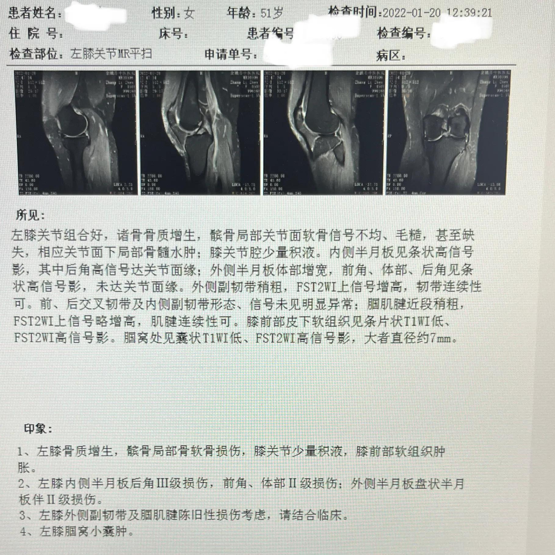 半月板的轻微损伤要注意什么,半月板损伤两年多了最好的方法