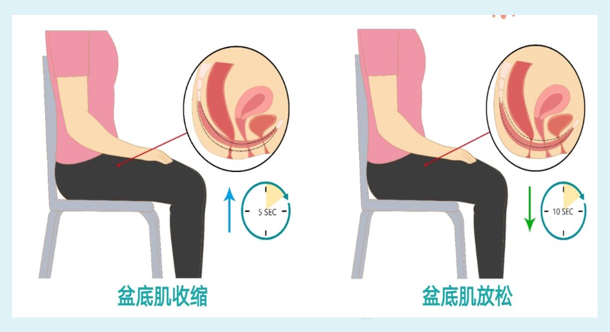 凯格尔盆底康复训练,kegel凯格尔运动音频