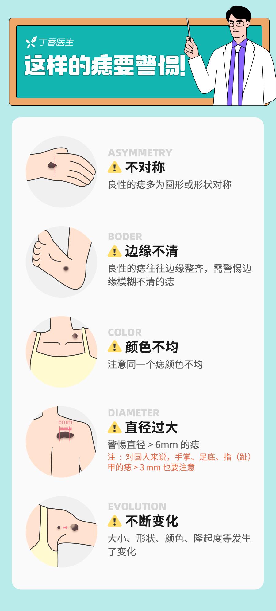 脸上长了一颗痣快40年了会癌变吗,手术切除痣之后还会有癌变风险吗