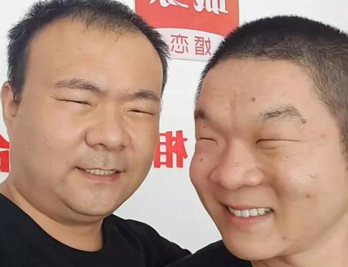 河南两男子眼太小去割双眼皮,河南两兄弟割双眼皮被劝退