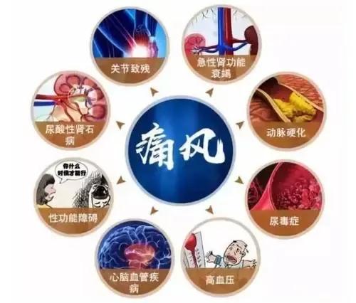 抑制痛风中药,缓解痛风的食物