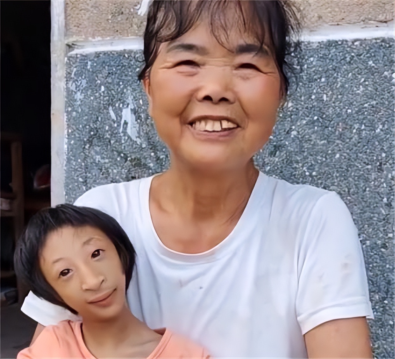 湖南一产妇生下“小猴子”,湖南妈妈生下小猴子杂技团要收吗