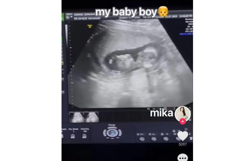 泰国手术变性网红,泰国做变性手术新闻