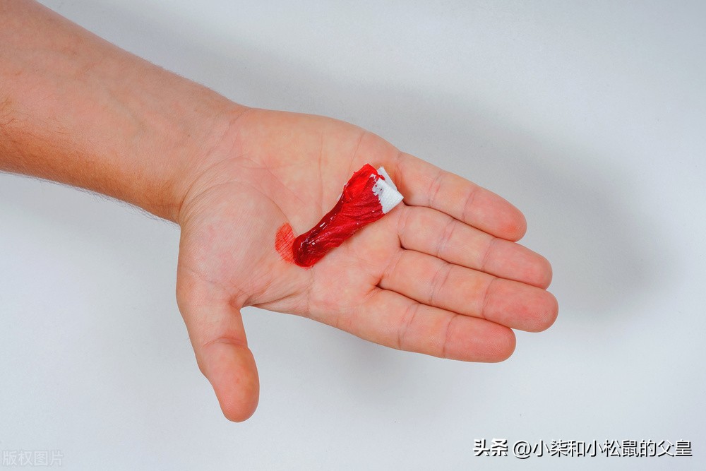 包皮环切术后出血正常吗,包皮套环术后出血