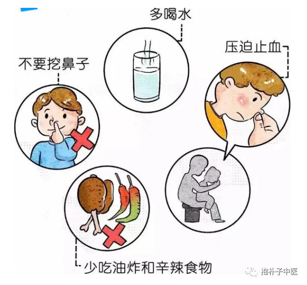 鼻出血，用线扎扎手指就止住了