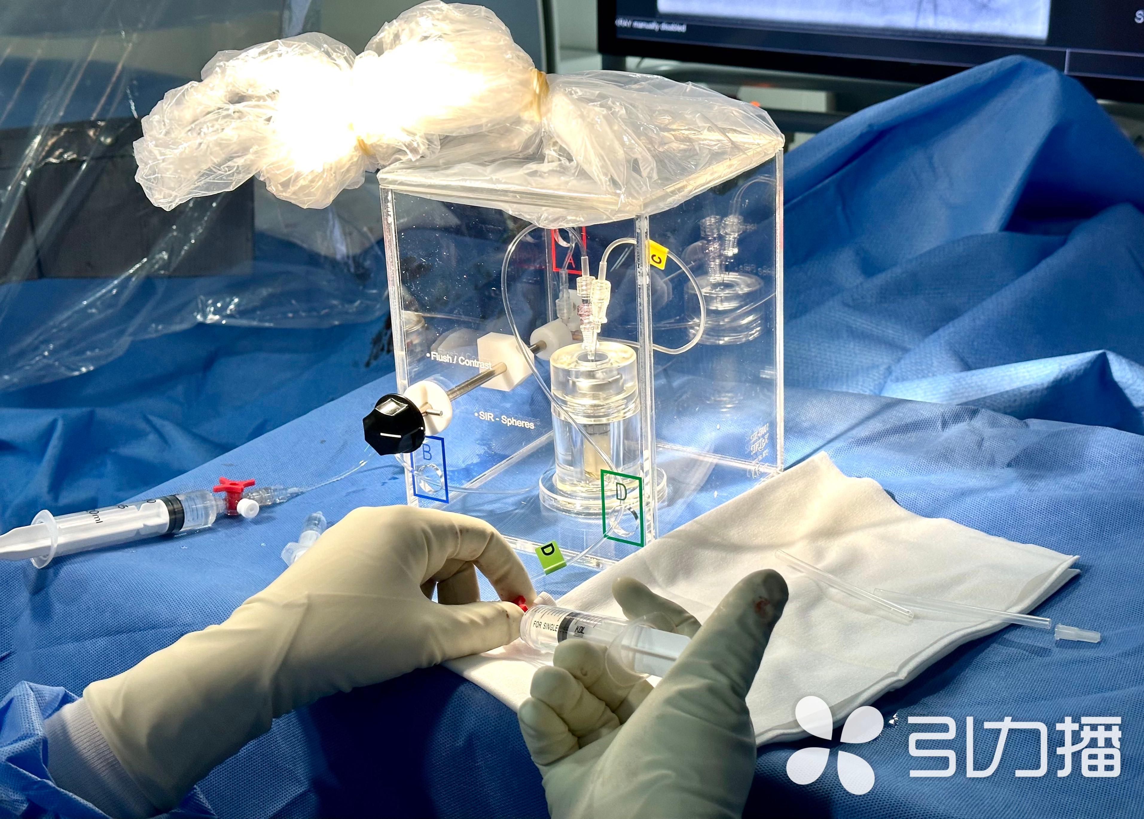 钇90治疗肝癌好的人有多少,海南第一例肝癌用钇90治疗