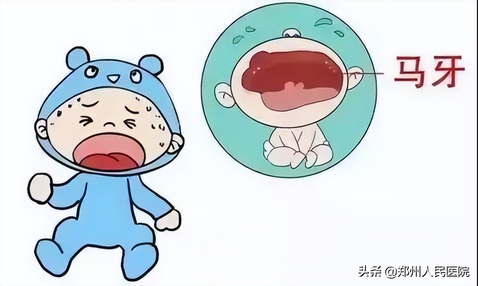 青记、马牙、假月经？别慌！新生儿这些情况都正常