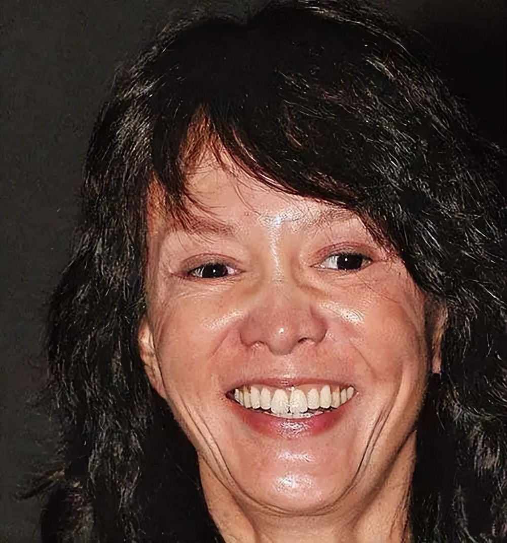 明星下颚骨整容后遗症,脸像鞋拔子怎么改善