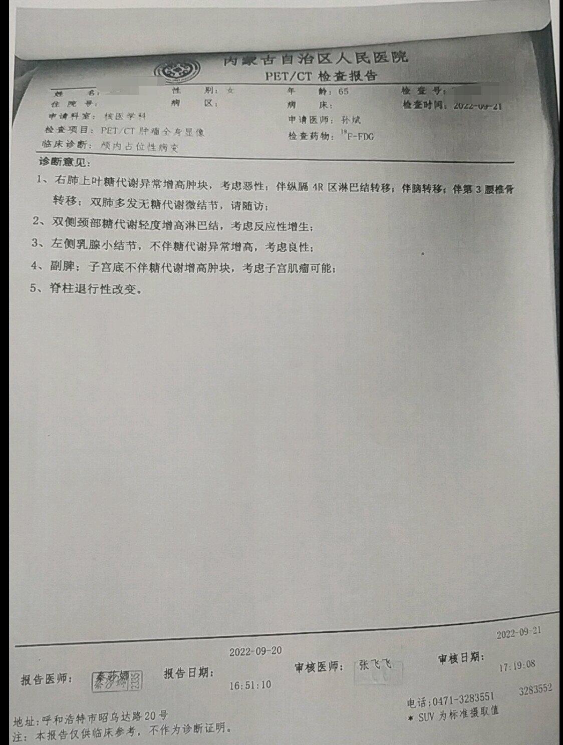 刘懿博士说肺癌的电影,刘懿谈肺癌五年存活率