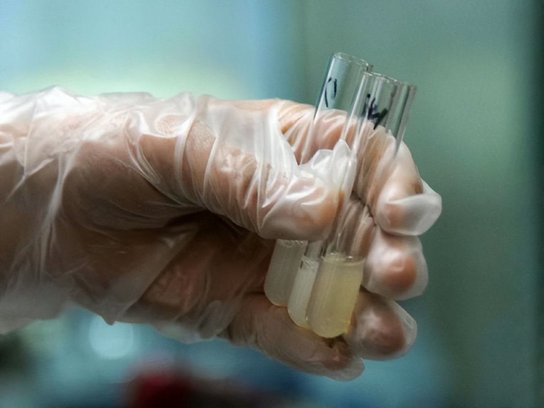 ​一滴精等于十滴血？男人要“省着”？真相到底是什么？今天揭秘