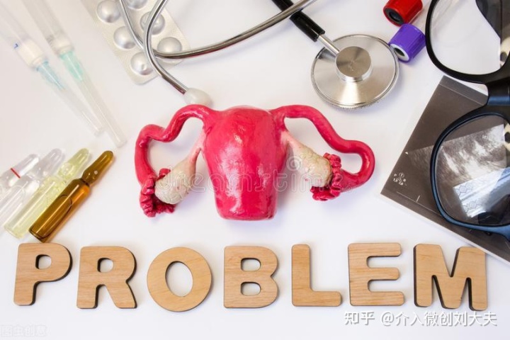 CT引导下介入硬化治疗卵巢巧克力囊肿临床研究招募