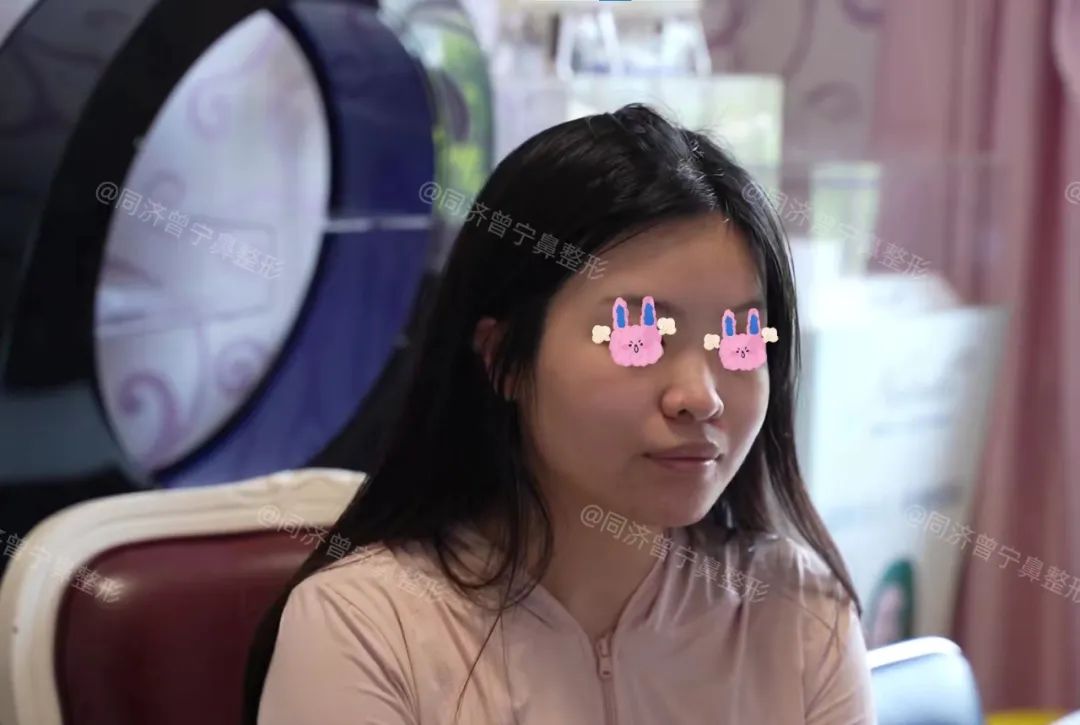 怎样让鼻子变立体精致,鼻子立体小技巧