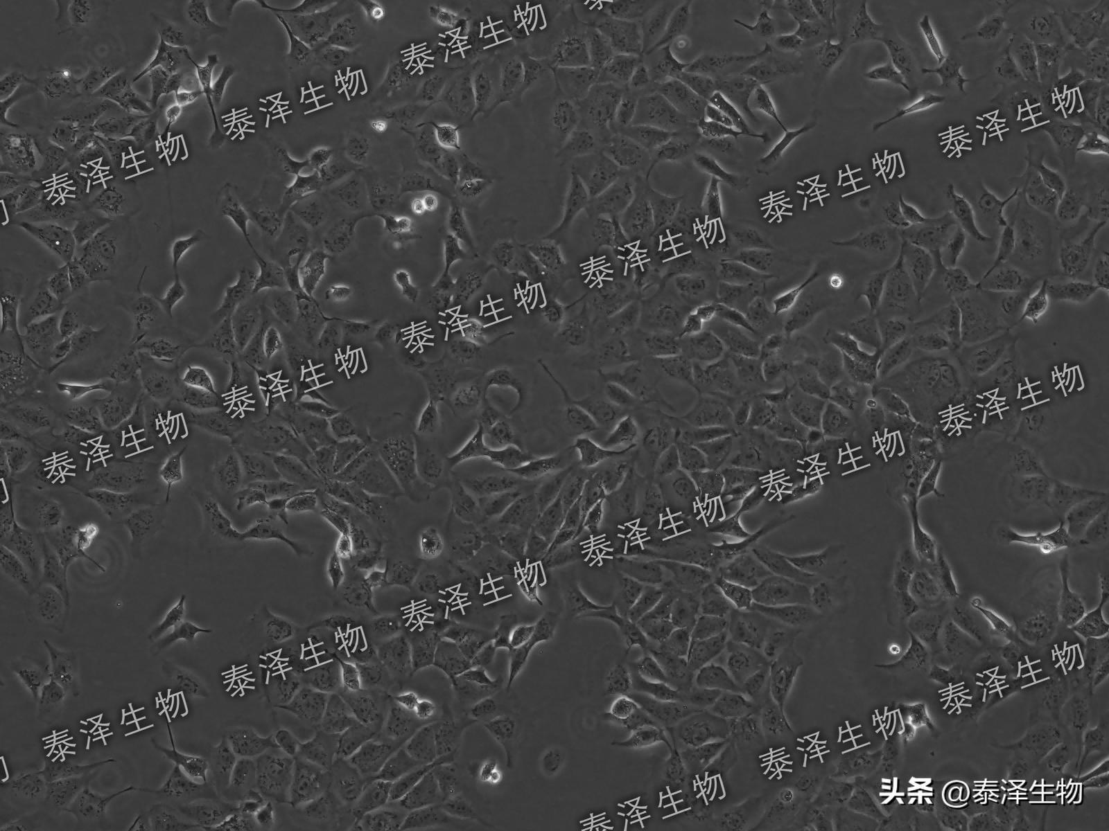 MDCK,NBL-2犬肾细胞基础介绍与培养传代