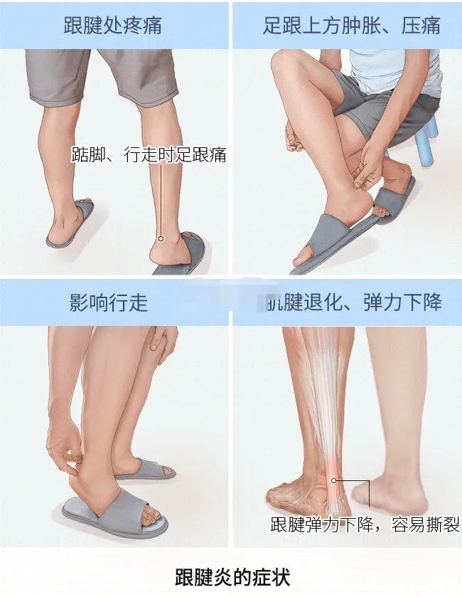 忽然脚特别疼不敢走路怎么回事,走路后脚跟疼痛是怎么回事