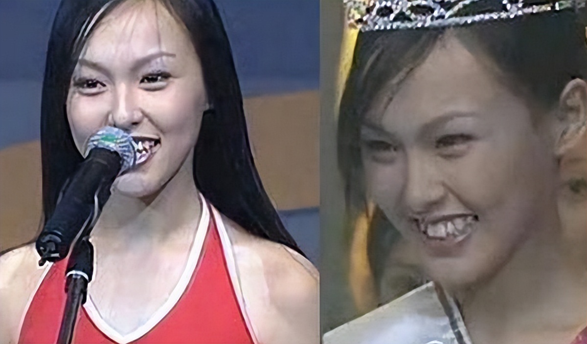 原形毕露！烤瓷牙“抢镜”忒显老，大概早已忘了“美人三分龅”