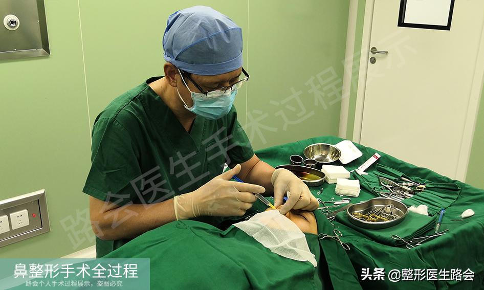 隆鼻手术全过程女生,隆鼻手术到底是怎么进行的