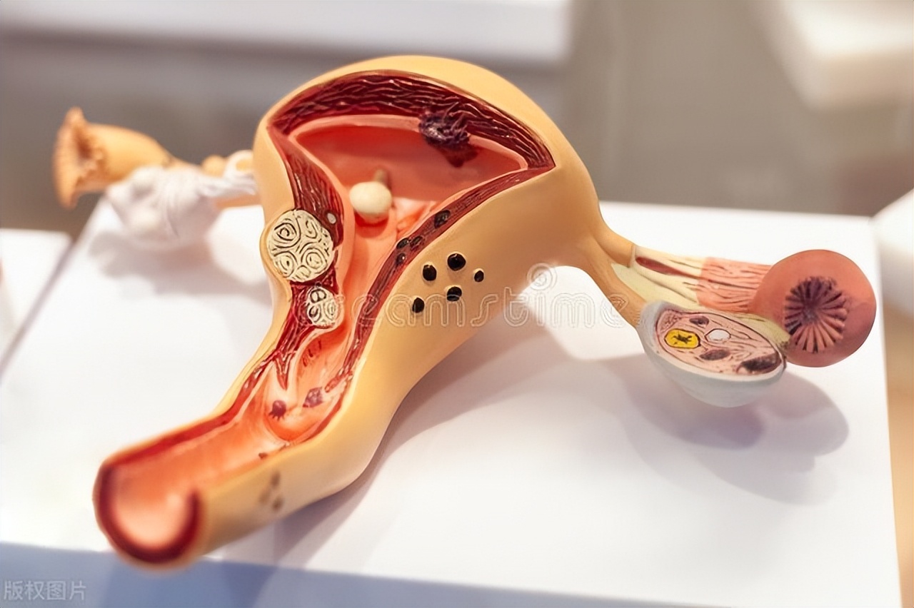 月经前体检卵巢囊肿,事业编体检有卵巢囊肿要复检吗