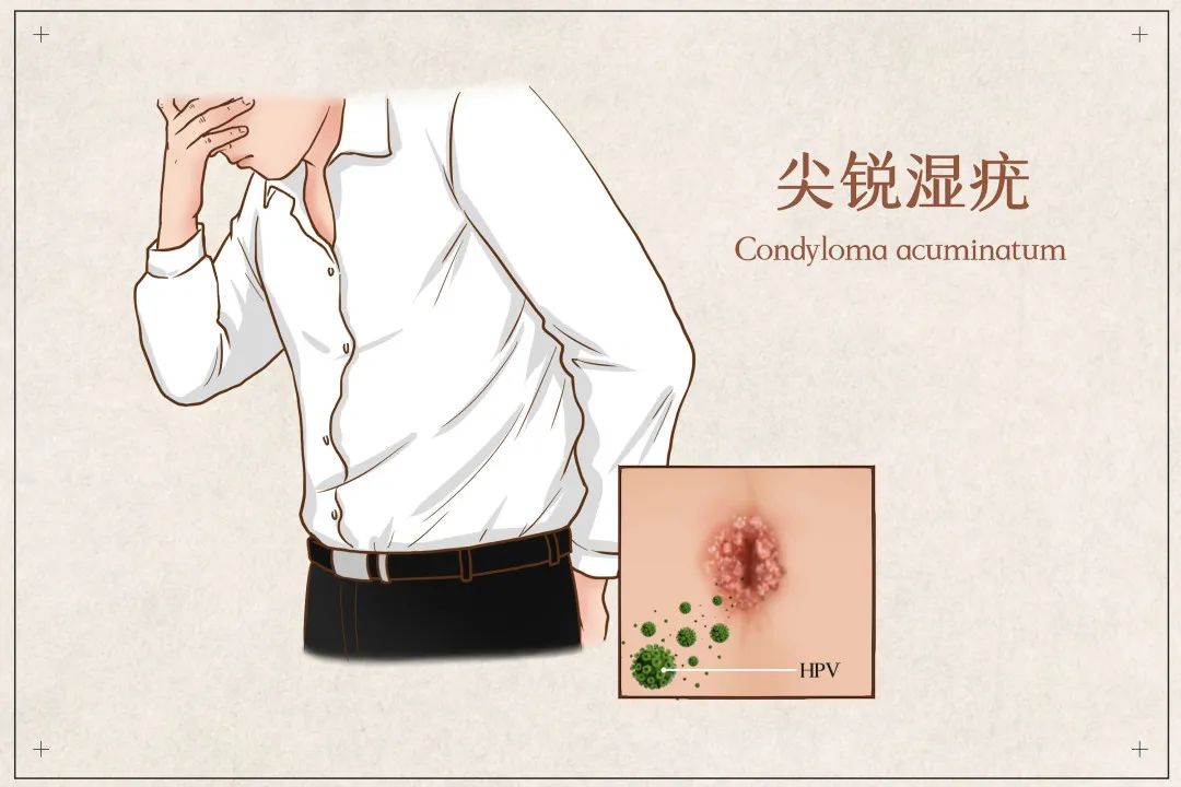 为什么会得性传播疾病男性,怎样知道男人有性传播疾病