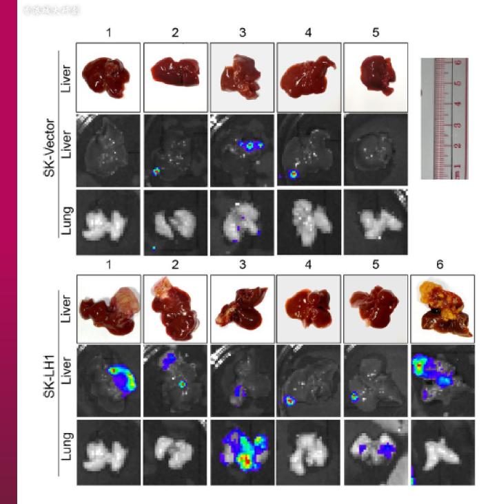 香港治疗癌症突破,香港癌症治疗最新突破