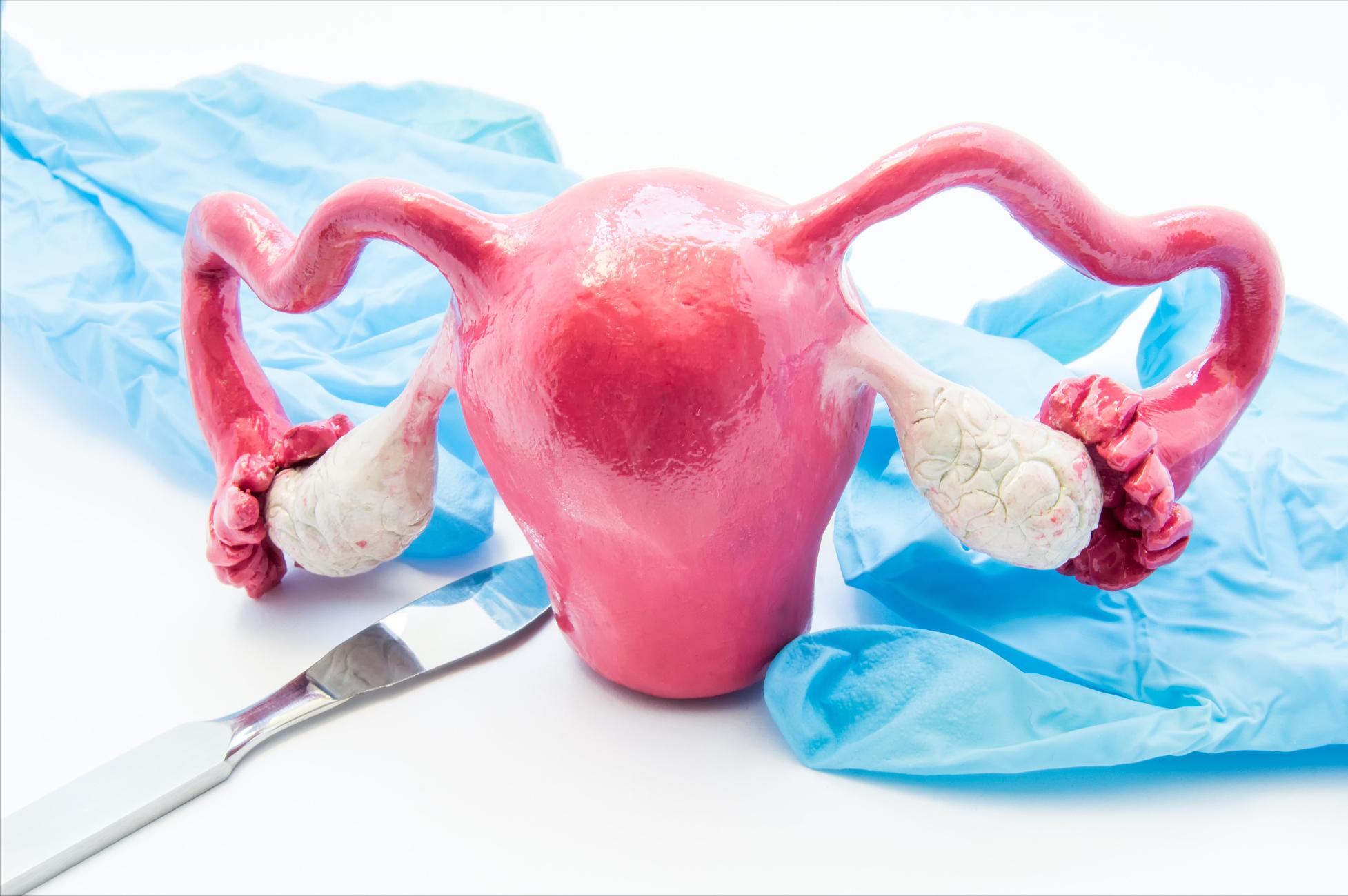 患上子宫肌瘤，身体会有这几种症状，女人别忽视了