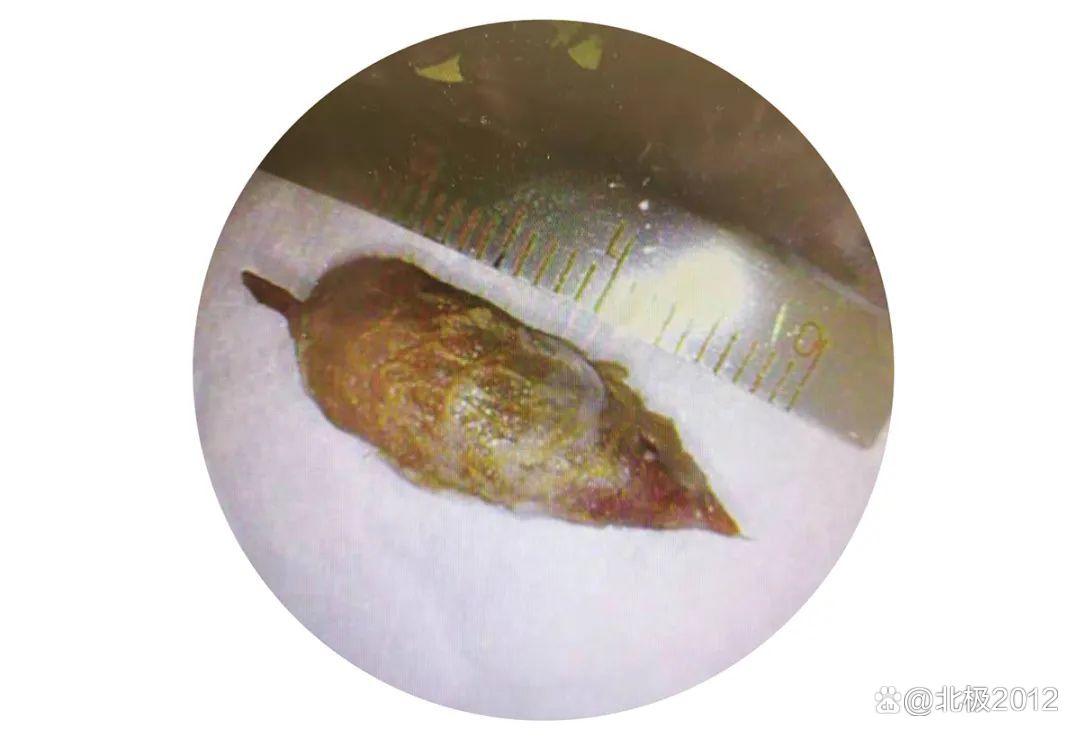 祸从口出如何解决,祸从口入吃什么食物