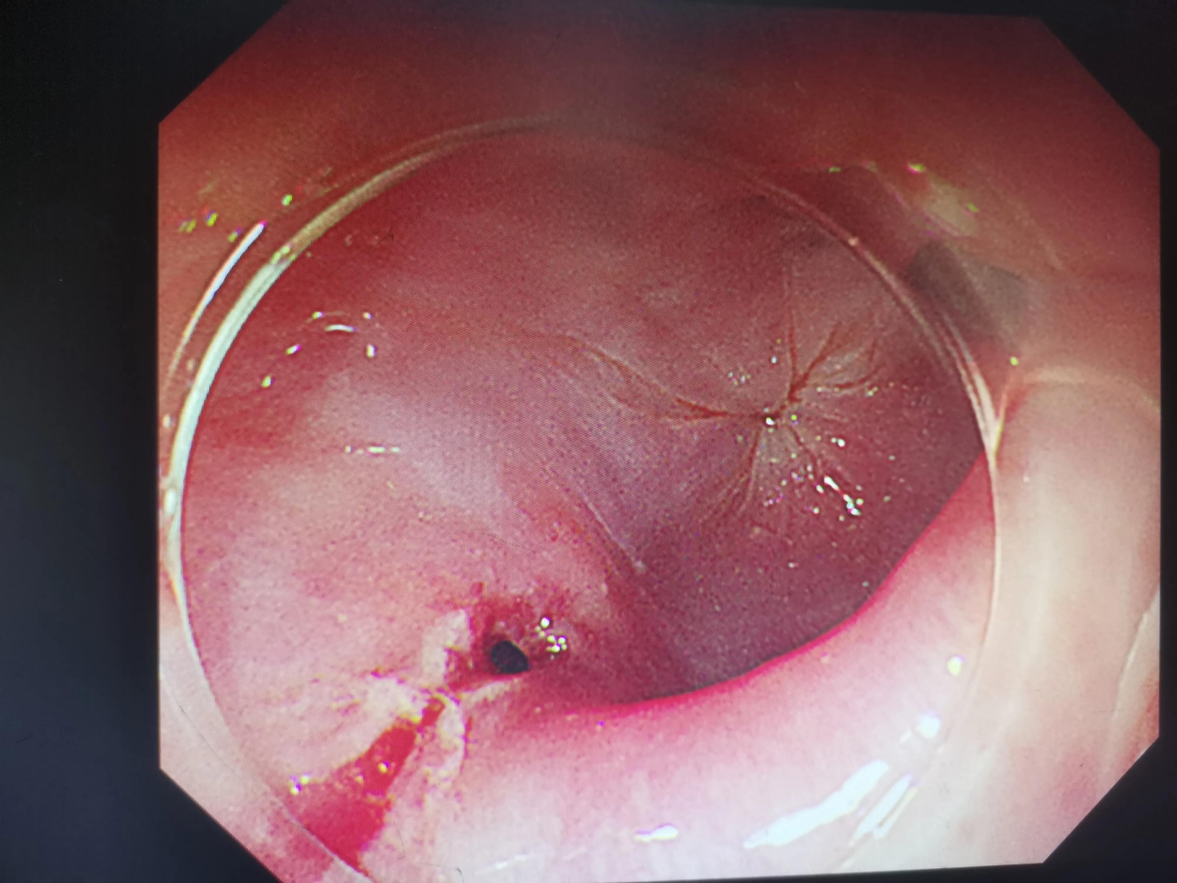 痛惜完整版原唱,痛惜和惋惜的区别