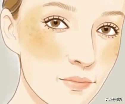 26年前，南阳人张毅的美容论文在《中医外治杂志》发表