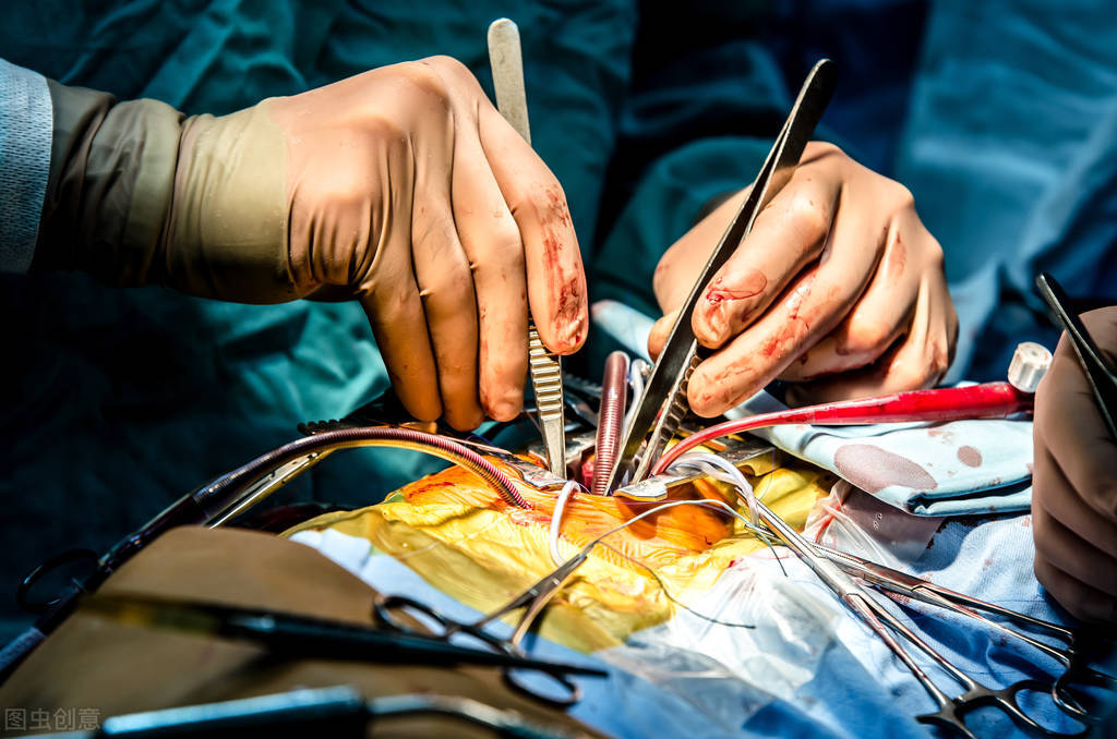 静脉曲张有哪些特效中药,专治静脉曲张特效药推选