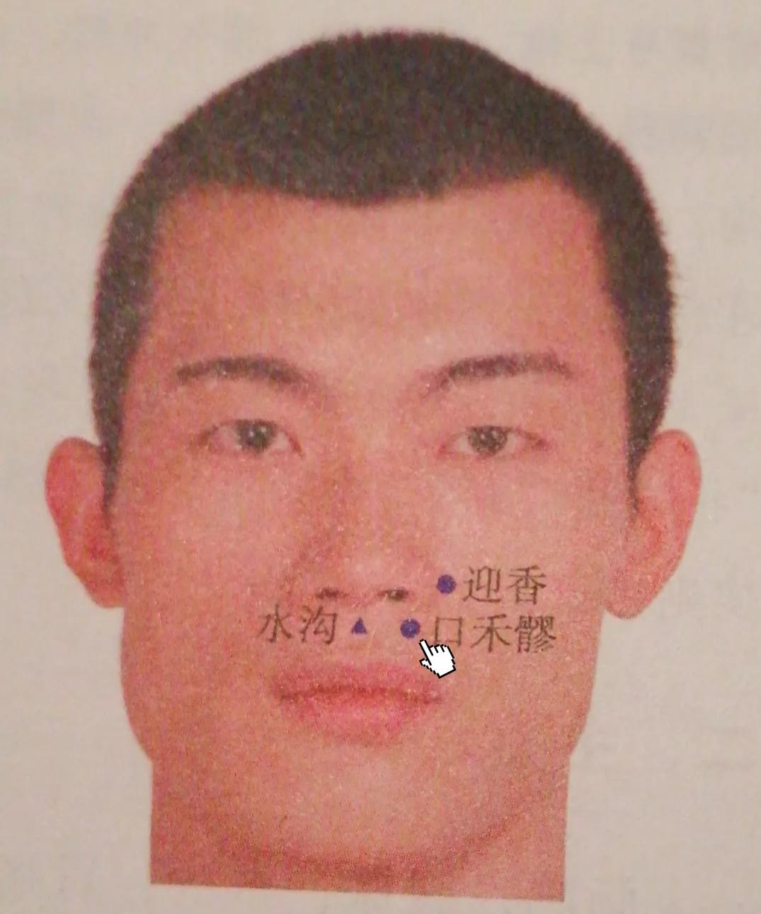 口禾髎穴准确位置,口禾髎穴和通天穴位置在哪