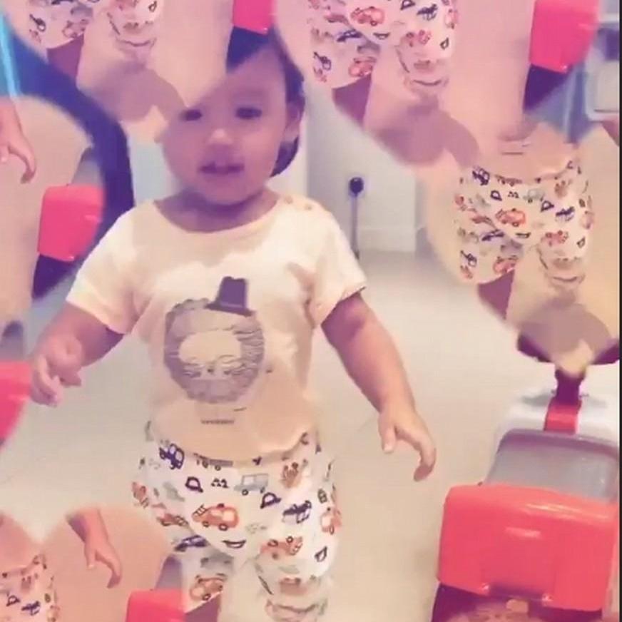 张柏芝被宠物狗咬脸,张柏芝小儿子受伤