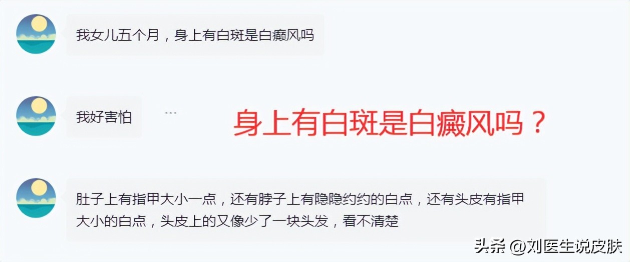 白癜风是什么引起的白癜风怎么治,得了白癜风怎么治白癜风效果好