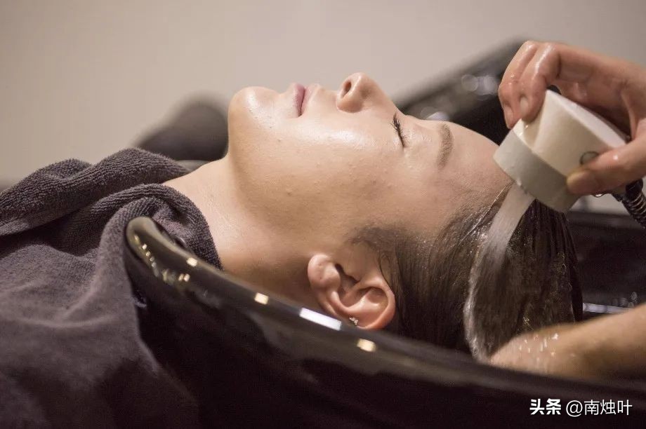 头油头痒头屑掉头发怎么治疗,头屑多头皮痒油头有什么好妙招