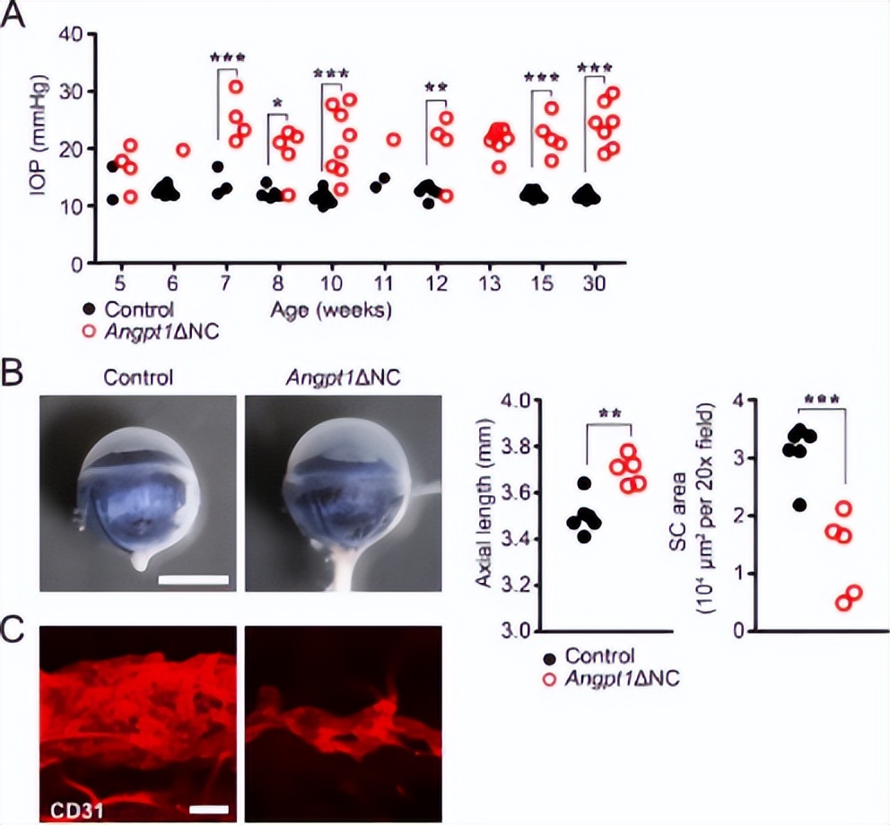 闭合性青光眼治疗突破,青光眼的修复之路