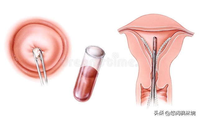 孕期各种困扰解决方法,孕期常见问题和处理方法