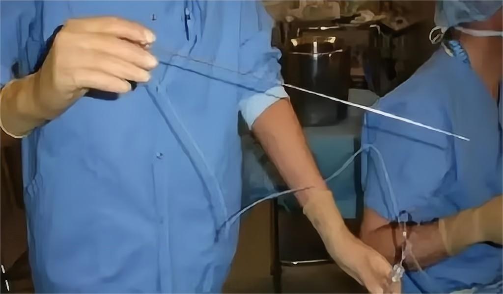 被小臂长的针刺穿阴道、卵巢，只为一部苹果手机，爱心捐卵何时休