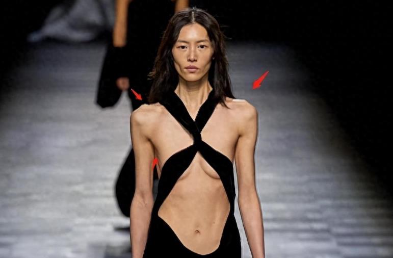 瘦到病态的审美,瘦到病态