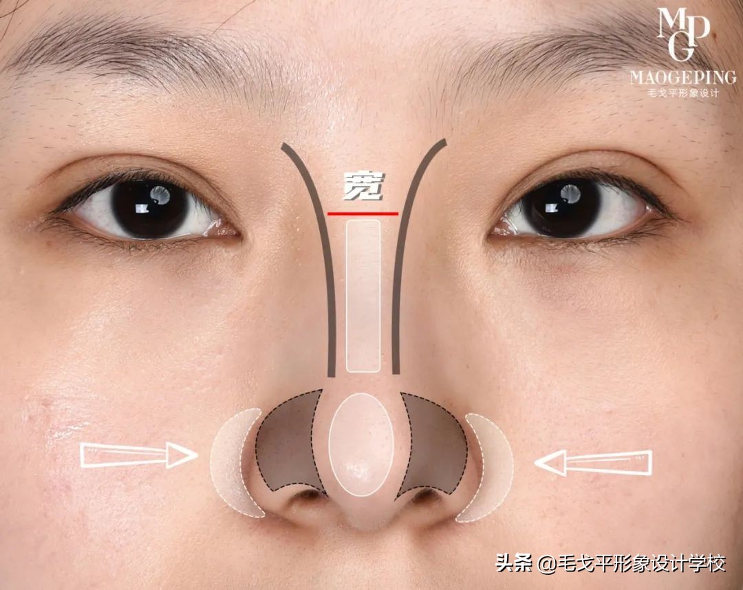 鼻小柱比鼻翼低怎么化妆,山根低大鼻头宽鼻翼修容