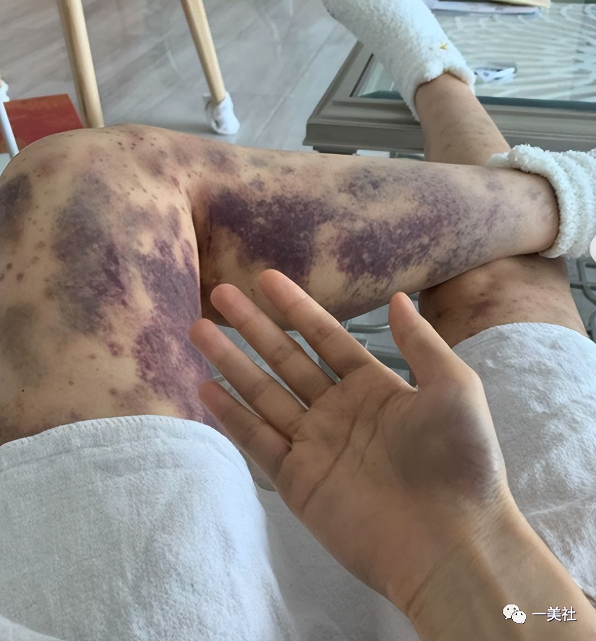 美容变毁容美容针还能不能打,曝光不可注射的美容针有哪些