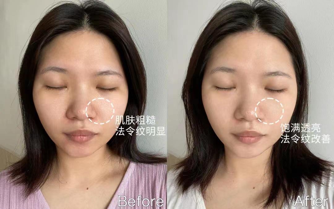 国货大战欧莱雅玻色因,欧莱雅和玻色因哪个好